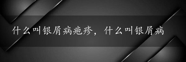 什么叫银屑病疱疹，什么叫银屑病