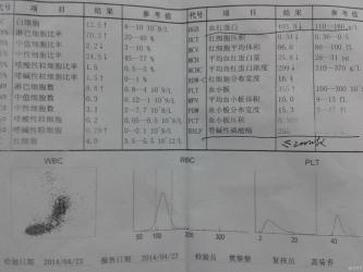 支气管炎症状悉数登场：识别与应对