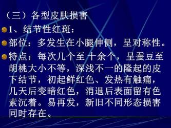 白塞病：一种全身性免疫系统疾病及其治疗方法