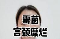 轻度宫颈糜烂如何治疗？专业指南助你摆脱困扰