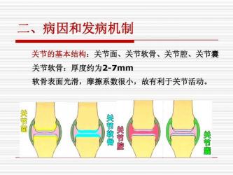 膝关节骨性关节炎：病因、病理及治疗全面解析