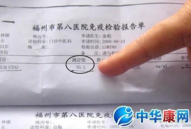 鳞状细胞癌抗原（SCC）解析：它究竟是什么？