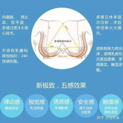 隆胸假体品牌选择：历史、优势与个人需求