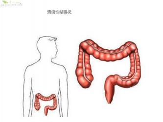 大便带血的原因及应对方法：痔疮、溃疡性结肠炎、直肠息肉等常见原因