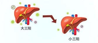 小三阳：乙肝病毒的潜在威胁与预防