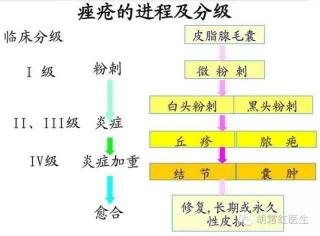 痤疮症状面面观：识别与应对不同类型的痘痘