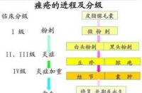 痤疮症状面面观：识别与应对不同类型的痘痘