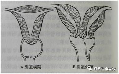 处女膜位置解析：女性生理的小秘密