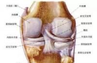 膝盖酸痛治疗全攻略：从肌肉损伤到风湿性关节炎，一篇看懂！
