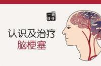 脑梗能治好么？科学解析与康复之路