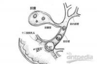 胆结石是怎么形成的？原因分析与预防策略