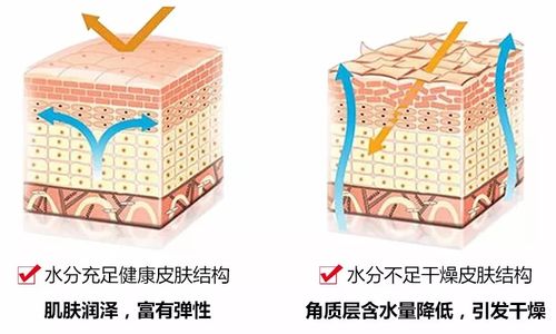 战胜痘疤：从药物治疗到自然疗法，全方位攻克肌肤难题