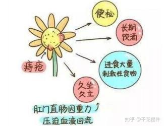 痔疮出血怎么办？这些治疗方法简单有效！