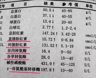 乙肝检测中的“大小三阳”解读：了解大三阳小三阳的真正含义