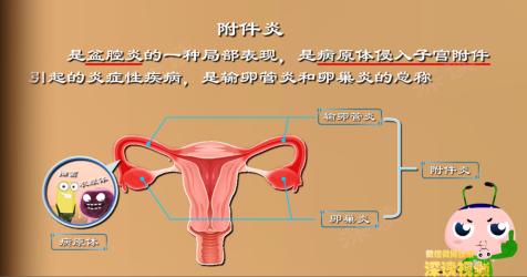 输卵管炎症状：如何识别并应对？