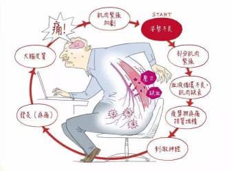 腰间盘突出压迫神经：疼痛之源与影响解析