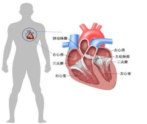 肥厚性心肌病：认识它，守护心脏健康