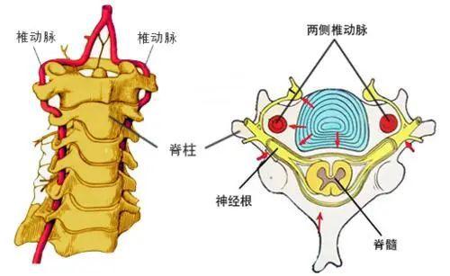 脊髓型颈椎病：认识症状，探索治疗方法