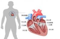 肥厚性心肌病：认识它，守护心脏健康