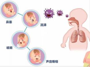 咳嗽的原因：从感冒到呼吸道疾病，一次性了解！