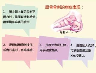 揭秘：骨质增生的真正元凶是什么？