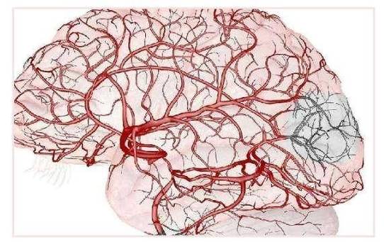 脑坏死是怎么造成的？了解坏死原因，守护大脑健康