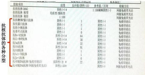 红斑狼疮会遗传吗？专家解读遗传风险与多元治疗策略