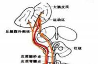 脑出血后遗症：了解症状，守护健康——一文带您认识脑出血后的常见并发症