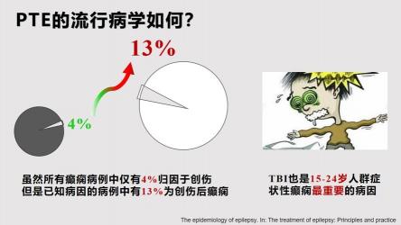 痫病病的治疗：全面解析手术治疗、中医治疗及日常护理策略