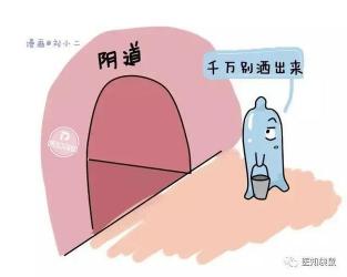 结扎对男性的影响：了解手术风险与恢复要点，助你安心避孕