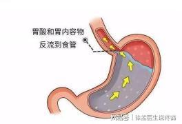 胃绞痛症状识别与日常护理：如何有效缓解胃部疼痛