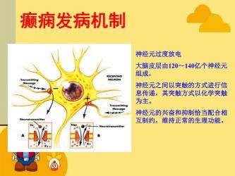 小儿癫痫的诊断：准确区分与个性化治疗的关键