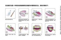 洁牙：原理、必要性及其口腔健康益处解析