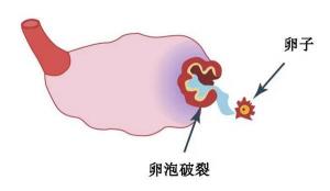 优势卵泡：怀孕准备中的关键因素