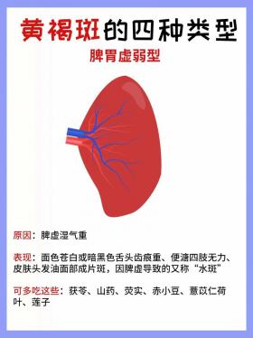 怎样预防黄褐斑：简单实用的护肤指南