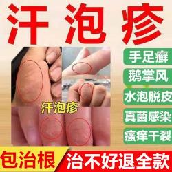 手气脚气：根治方法与预防措施