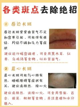 怎么去掉色斑：6种实用方法让你拥有亮丽肌肤