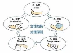 手腕扭伤怎么办：7种应对方法，助你快速恢复