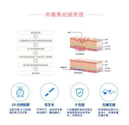 韩国粉毒与白毒肉毒毒素的区别：效果、安全性与外观全面解析