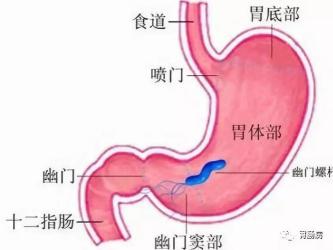 胃癌的症状有哪些？从食欲降低到消化道出血