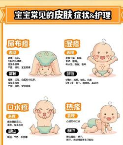 幼儿急疹的症状：识别、应对与护理指南