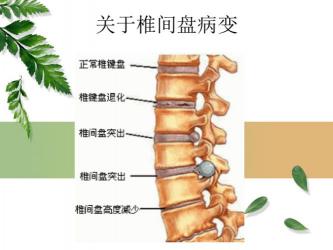 脊柱疼：生理与病理因素全面解析