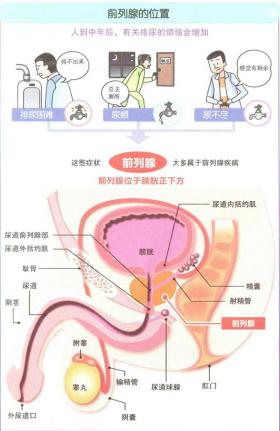 前列腺炎的治疗方法：日常调理、药物治疗与手术治疗