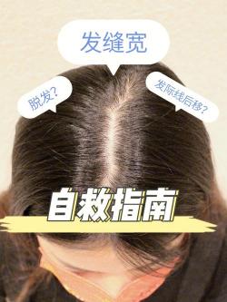 头发白的原因大揭秘：年龄、压力还是疾病？一文带你找到答案