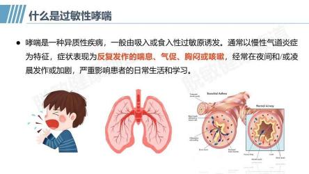 儿童过敏性哮喘：全方位解析症状、治疗与预防措施