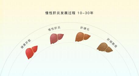 丙型肝炎抗体解析：了解它，预防丙肝的第一步