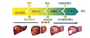 丙肝能治愈吗？治疗方法与效果详解