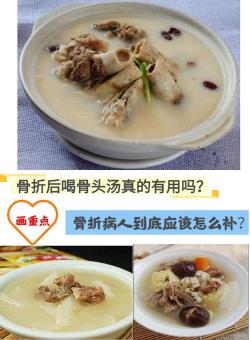 骨折病人吃什么好？营养专家推荐的食物清单