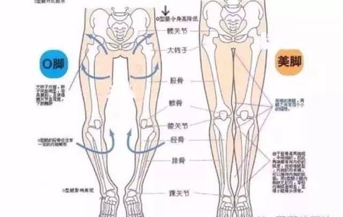 膝盖弯曲时疼痛的可能原因及应对方法