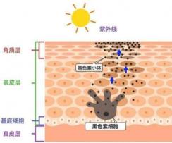 去黄褐斑有效的方法大揭秘，重拾美丽信心！